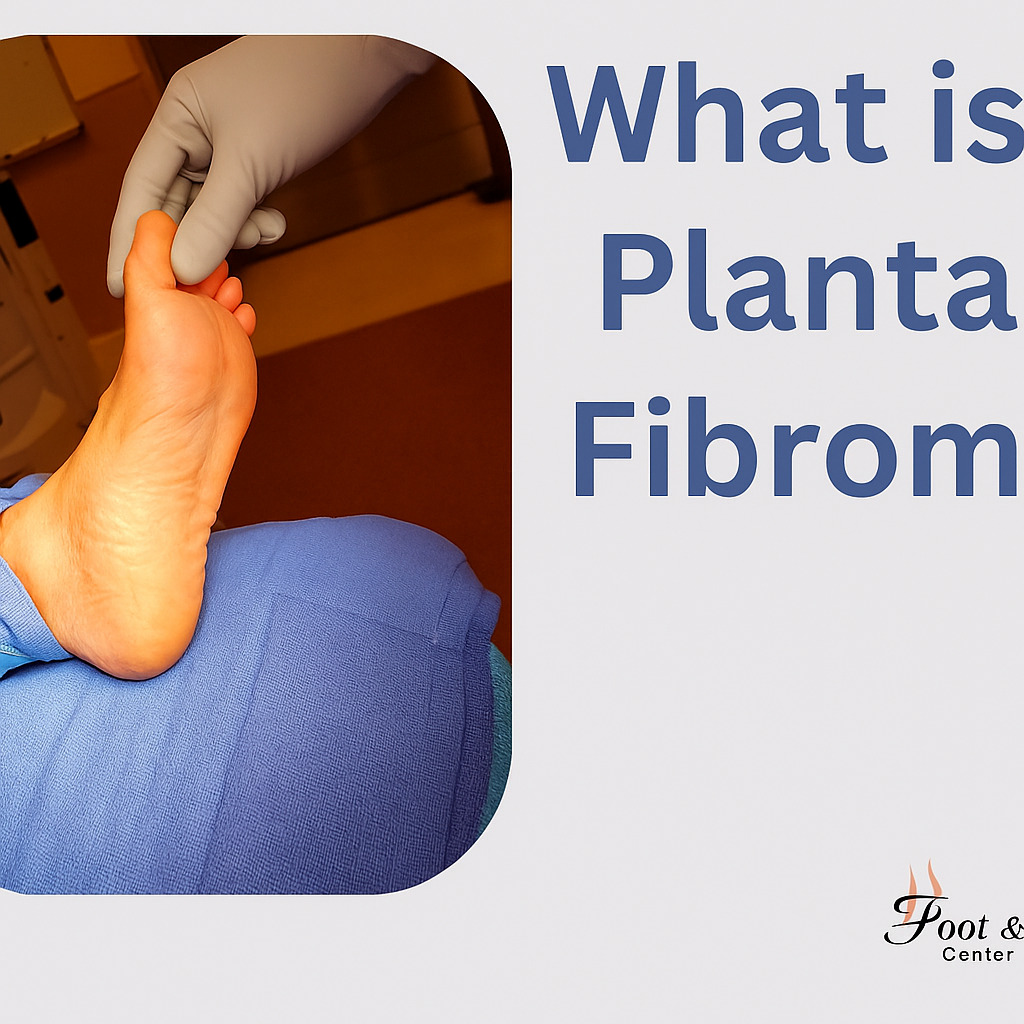 what is a plantar fibroma